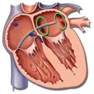 Indmunding af lungevener.