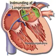 Indmunding af lungevener.