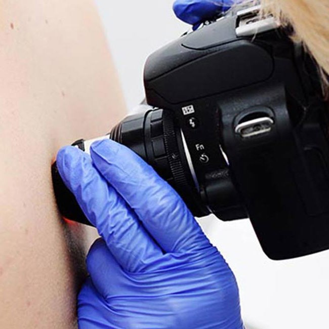 Læge udfører hudanalyse på patient.