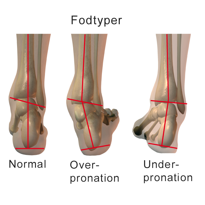 Illustration af ankelled set bagfra med forskellige pronationer.