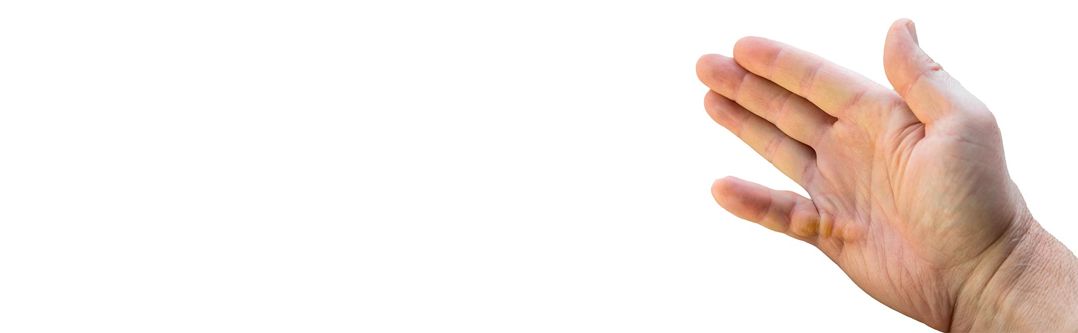 Billede af hånd med en kuskefinger.