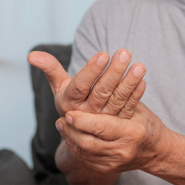 En mand holder om sin hånd på grund af smerter.