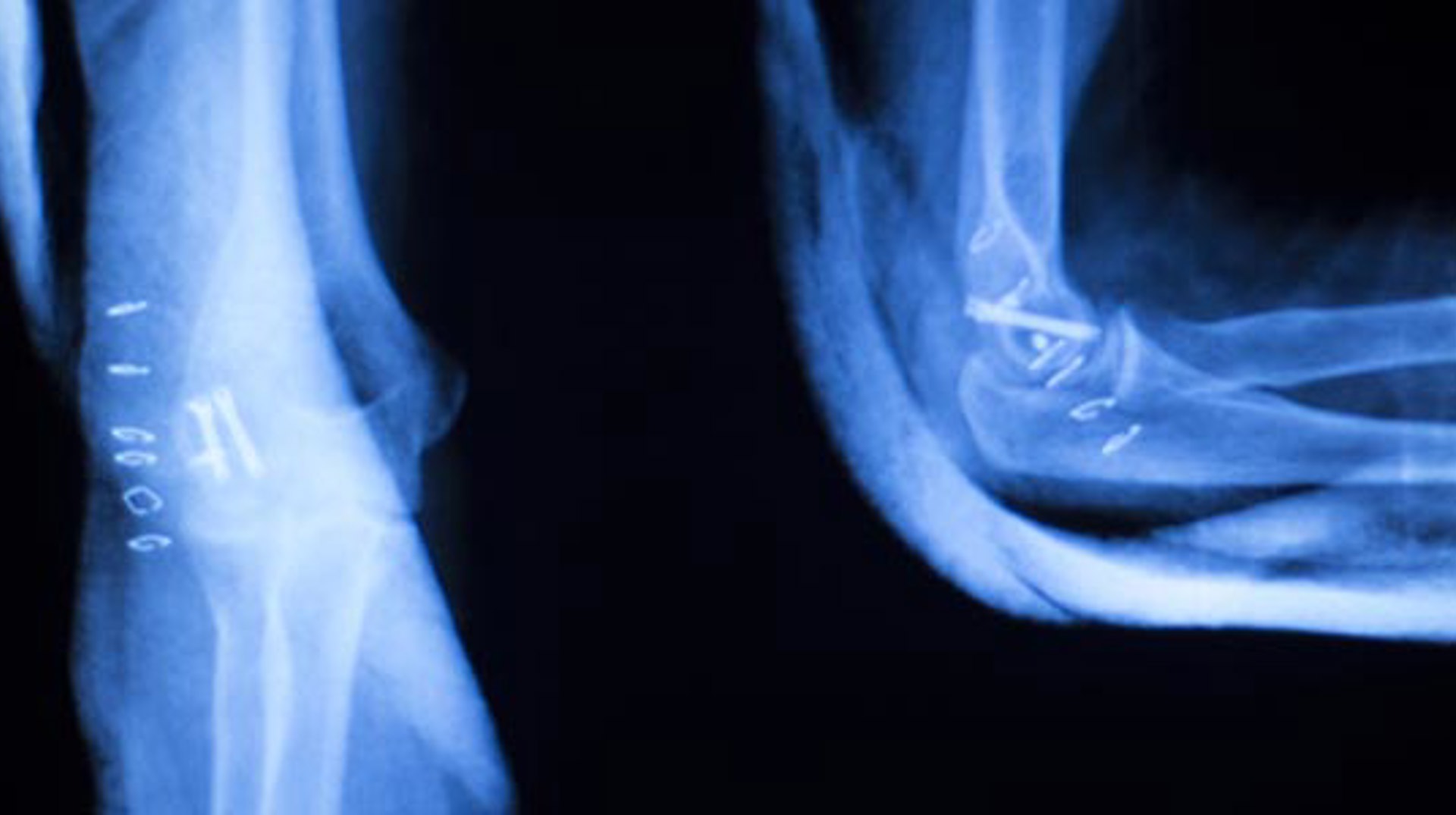 Hurtig CT-scanning | Brug din henvisning hos os