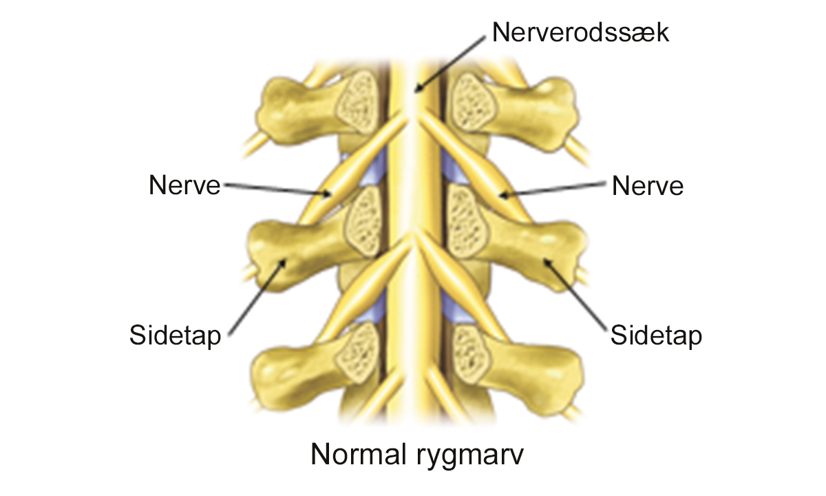 Illustration af normal rygmarv.